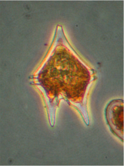 Photo of Protoperidinium oceanicum by Dr. Vera Trainer and Brian Bill, NOAA