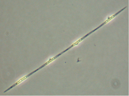 Image of small cell Pseudo-nitzschia by Brian Bill, NOAA